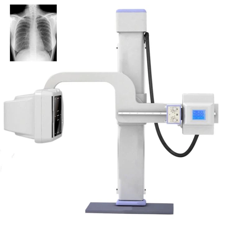 Nagyfrekvenciás digitális röntgensugár