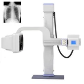 Nagyfrekvenciás digitális röntgensugár