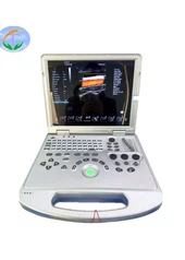 Kiváló minőségű ultrahang diagnosztikai rendszer