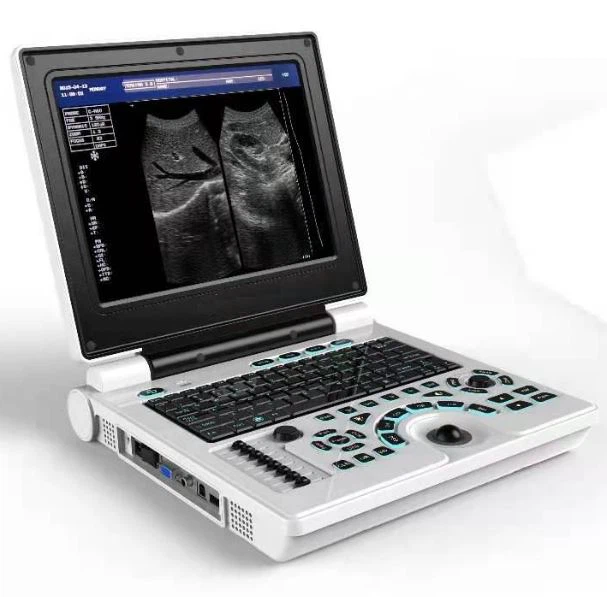 Színes Doppler ultrahangos diagnosztikai rendszer