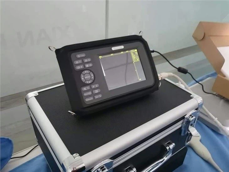 YJ-V20 Medical Ultrasound Scanner With Rectal Probe