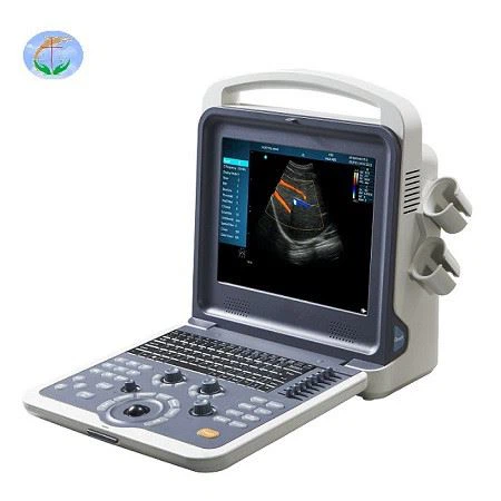 Hot Sale 2d Ultrasound Scanner Color Doppler Medical Portable Usg