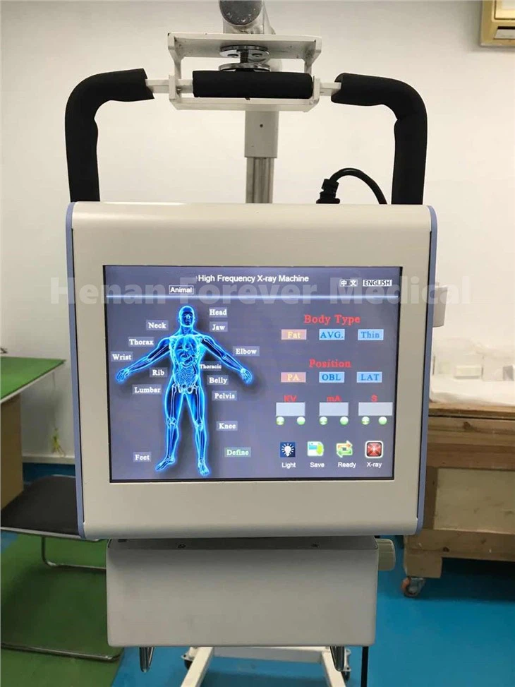 5kW Digital Portable X-ray Machine YJ-X050-C